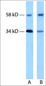 Anti-CDK6 antibody produced in rabbit IgG fraction of antiserum