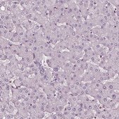 Anti-CHIT1 antibody produced in rabbit Prestige Antibodies® Powered by Atlas Antibodies, affinity isolated antibody, buffered aqueous glycerol solution