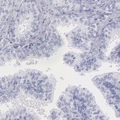 Anti-MB antibody produced in rabbit Prestige Antibodies® Powered by Atlas Antibodies, affinity isolated antibody, buffered aqueous glycerol solution