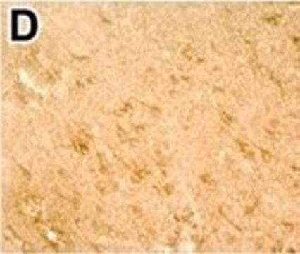 Anti-DNMT1 antibody produced in rabbit Prestige Antibodies® Powered by Atlas Antibodies, affinity isolated antibody, buffered aqueous glycerol solution