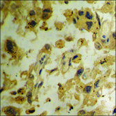 Anti-phospho-ADAM 17 (pThr735) antibody produced in rabbit affinity isolated antibody
