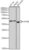 Anti-ATP4B antibody produced in rabbit
