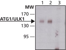 抗Atg1/ULK1 ~1 mg/mL, affinity isolated antibody, buffered aqueous solution