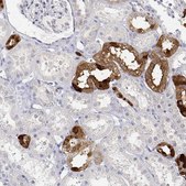 Anti-CALB1 antibody produced in rabbit Prestige Antibodies® Powered by Atlas Antibodies, affinity isolated antibody, buffered aqueous glycerol solution