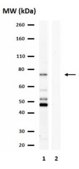Anti-Choline Transporter Antibody from rabbit, purified by affinity chromatography