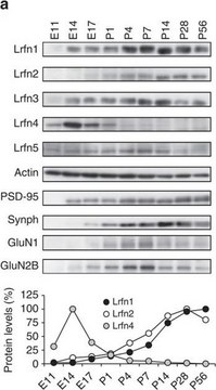Anti-Synapsin I Antibody Chemicon®, from rabbit