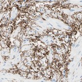 Anti-MFAP5 antibody produced in rabbit Prestige Antibodies® Powered by Atlas Antibodies, affinity isolated antibody, buffered aqueous glycerol solution