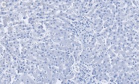 Anti-Catalase Antibody, clone 1C21 ZooMAb® Rabbit Monoclonal recombinant, expressed in HEK 293 cells
