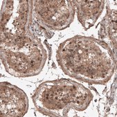 Monoclonal Anti-RBCK1 antibody produced in mouse Prestige Antibodies® Powered by Atlas Antibodies, clone CL4289, purified immunoglobulin