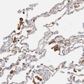 抗-TFRC 兔抗 Prestige Antibodies® Powered by Atlas Antibodies, affinity isolated antibody, buffered aqueous glycerol solution