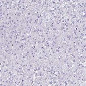 Anti-TNNT2 antibody produced in rabbit Prestige Antibodies® Powered by Atlas Antibodies, affinity isolated antibody, buffered aqueous glycerol solution