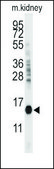 Anti-CDA (C-term) antibody produced in rabbit saturated ammonium sulfate (SAS) precipitated, buffered aqueous solution