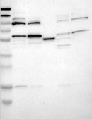 Anti-DRD1 antibody produced in rabbit Prestige Antibodies® Powered by Atlas Antibodies, affinity isolated antibody, buffered aqueous glycerol solution