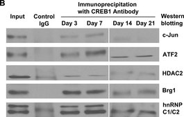 抗HDAC2抗体，克隆3F3 clone 3F3, Upstate®, from mouse