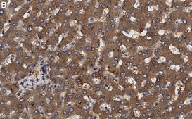 Anti-Transferrin Antibody, clone 2B8 , ZooMAb® Rabbit Monoclonal recombinant, expressed in HEK 293 cells