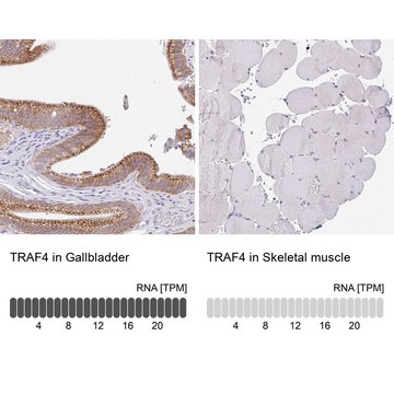 Anti-TRAF4 antibody produced in rabbit Prestige Antibodies® Powered by Atlas Antibodies, affinity isolated antibody, buffered aqueous glycerol solution
