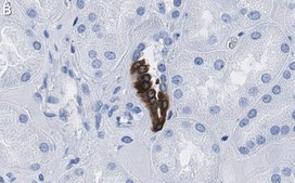 Anti-COX2 Antibody, clone 2B19 ZooMAb® Rabbit Monoclonal recombinant, expressed in HEK 293 cells