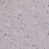 Anti-SDC1 antibody produced in rabbit Prestige Antibodies® Powered by Atlas Antibodies, affinity isolated antibody, buffered aqueous glycerol solution