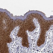 Anti-PHGDH antibody produced in rabbit Prestige Antibodies® Powered by Atlas Antibodies, affinity isolated antibody, buffered aqueous glycerol solution, Ab2