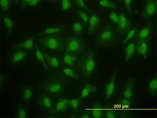 Monoclonal Anti-SMAD2 antibody produced in mouse clone 3G9, purified immunoglobulin, buffered aqueous solution