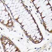 Anti-RPS20 antibody produced in rabbit