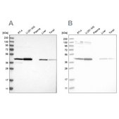 Anti-CNP antibody produced in rabbit Prestige Antibodies® Powered by Atlas Antibodies, affinity isolated antibody, buffered aqueous glycerol solution, Ab3