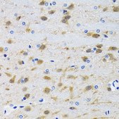 Anti-MAPK9 antibody produced in rabbit