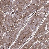 Monoclonal Anti-LAMB2 antibody produced in mouse Prestige Antibodies® Powered by Atlas Antibodies, clone CL2979, purified immunoglobulin, buffered aqueous glycerol solution