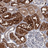 Anti-C20orf196 antibody produced in rabbit Prestige Antibodies® Powered by Atlas Antibodies, affinity isolated antibody, buffered aqueous glycerol solution