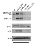 Anti-phospho NFkB p52, (Ser222) Antibody from rabbit, purified by affinity chromatography
