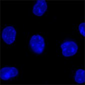 U2OS BFP-LMNB1 RFP-ACTB