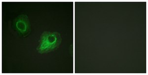 Anti-VEGFR2 antibody produced in rabbit affinity isolated antibody