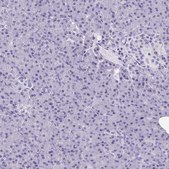 Anti-MORC4 antibody produced in rabbit Prestige Antibodies® Powered by Atlas Antibodies, affinity isolated antibody, buffered aqueous glycerol solution