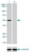 Monoclonal Anti-ACP2 antibody produced in mouse clone M1-4A12, purified immunoglobulin, buffered aqueous solution