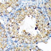 Anti-ALDH1A2 antibody produced in rabbit