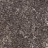 Anti-RAD21 antibody produced in rabbit Prestige Antibodies® Powered by Atlas Antibodies, affinity isolated antibody, buffered aqueous glycerol solution