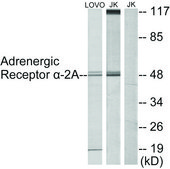 抗-肾上腺素受体 α-2A 兔抗 affinity isolated antibody