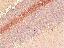 抗 呆蛋白 兔抗 IgG fraction of antiserum, buffered aqueous solution