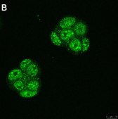 Anti-Ubiquilin 4 Antibody, clone 5K6 ZooMAb® Rabbit Monoclonal recombinant, expressed in HEK 293 cells