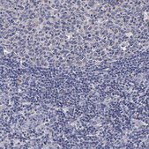 Anti-ENO3 antibody produced in rabbit Prestige Antibodies® Powered by Atlas Antibodies, affinity isolated antibody, buffered aqueous glycerol solution