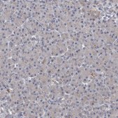 Anti-ALDH5A1 antibody produced in rabbit Prestige Antibodies® Powered by Atlas Antibodies, affinity isolated antibody, buffered aqueous glycerol solution, ab1