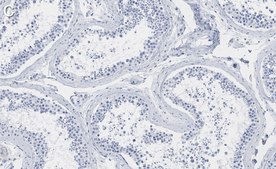 Anti-SUZ12 Antibody, clone 2E2 ZooMAb® Rabbit Monoclonal recombinant, expressed in HEK 293 cells