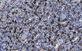 Anti-Heme Oxygenase 1 Antibody, clone 1F8 ZooMAb® Rabbit Monoclonal recombinant, expressed in HEK 293 cells