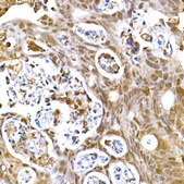 Anti-SOCS1 Antibody, clone 5T6Z10, Rabbit Monoclonal