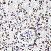 Anti-Phospho-STAT5A-Y694 antibody produced in rabbit