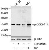 Anti-Phospho-CDK1-T14 antibody produced in rabbit