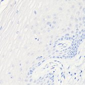 Anti-CDKN2A/p16INK4a antibody produced in mouse