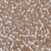 Anti-FGFR4 antibody produced in rabbit Prestige Antibodies® Powered by Atlas Antibodies, affinity isolated antibody, buffered aqueous glycerol solution