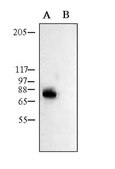 Anti-Potassium Channel Kv1.1 Antibody Chemicon®, from rabbit
