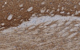 Anti-VGluT1 Antibody, clone 4O15, ZooMAb® Rabbit Monoclonal recombinant, expressed in HEK 293 cells